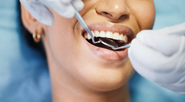 Best Dental Abscess Treatment in Hampton, IA