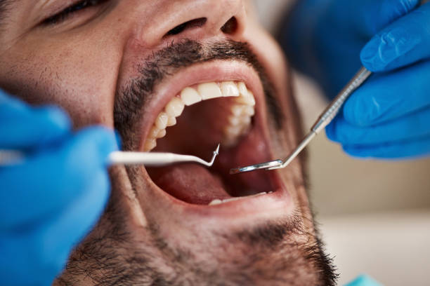 Best Emergency Treatment for Oral Infections in Hampton, IA