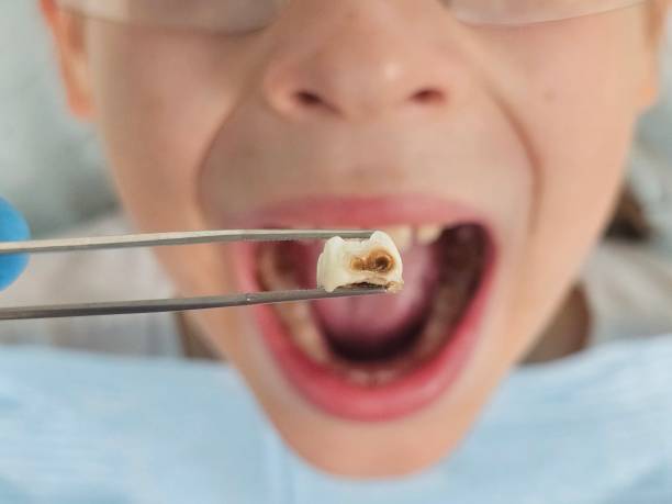 Best Emergency Care for Gum Disease in Hampton, IA